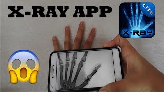 XRay App [upl. by Brenton]