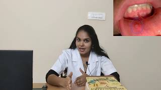 MOUTH ULCERS Types Reasons treatment and Tips APHTHOUS ULCERCANKER SORES TRAUMATIC ULCER [upl. by Ahsilrae]