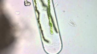 Spirogyra  Filamentous Green Algae [upl. by Sremlahc]