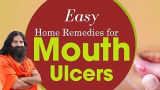 Easy Home Remedies For Mouth Ulcers  Swami Ramdev [upl. by Rutan44]