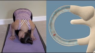 Half Somersault Maneuver to Treat BPPV Vertigo [upl. by Kerek]