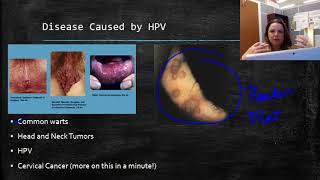 Human Papillomavirus HPV [upl. by Gerkman]