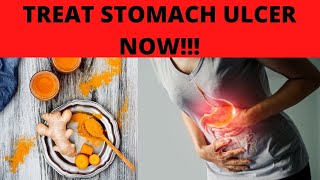 STOMACH ULCER TREATMENT AT HOME [upl. by Pellikka]