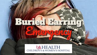 Buried Earring Emergency [upl. by Joelly]