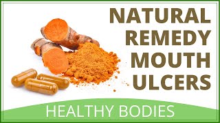 How To Cure Mouth Ulcers Fast Naturally [upl. by Zobkiw]