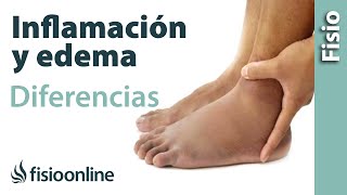 Inflamación y edema  Diferencias y características [upl. by Joan]