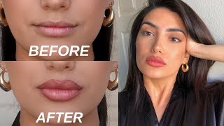 HOW TO FAKE BIG LIPS IN 3 EASY STEPS OMG [upl. by Arehsat]