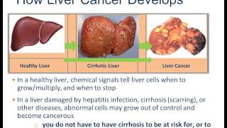 Hepatitis B CDC Viral Hepatitis Serology Training [upl. by Enatan967]