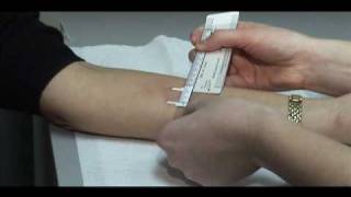 TB Skin Test  Mantoux Method [upl. by Oalsinatse532]