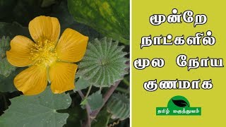 மூன்றே நாட்களில் மூல நோய் குணமாக  Thuthi ilai uses in Tamil  Abutilon Indicum for Piles [upl. by Eittod]