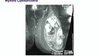 Soft tissue pathology  Dr Montgomery Hopkins BSTPATH [upl. by Nerua]