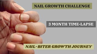 NAIL BITER GROWTH JOURNEY  Nail Growth Time Lapse  I Quit Nail Biting [upl. by Elletsyrk69]