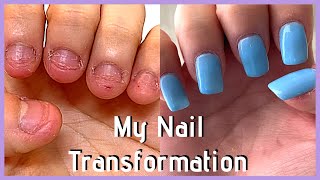 UPDATE My FAST Nail Transformation in 2020 nail journey part 5 [upl. by Prentice]