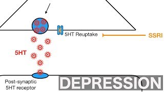 Major Depression and SSRIsSNRIs [upl. by Dnaltiak]