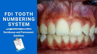 FDI Tooth Notation System  Tooth numbering system [upl. by Cassi]