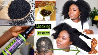 4 Ways to Use Pure Black Seed Oil For Massive hair Growth and For over all Health [upl. by Inesita]