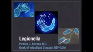 Legionella  Patrick Kenney MD [upl. by Emlynn]