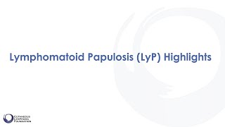 Diagnosis Lymphomatoid Papulosis [upl. by Gilliam]