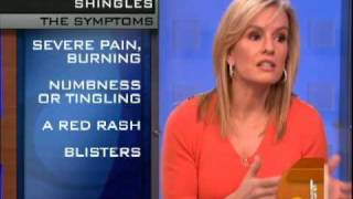 Shingles Virus Explained [upl. by Kathleen]