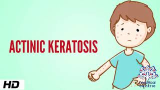 Actinic keratosis Causes Signs and Symptoms Diagnosis and Treatment [upl. by Karel]