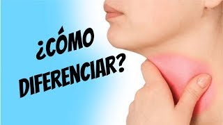 ¿Cómo diferenciar una faringitis viral y bacteriana Estreptococo beta hemolítico [upl. by Airliah266]