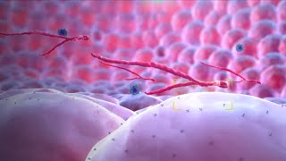 Ebola Virus  Mechanism of Action  3D Medical Animation [upl. by Leonerd]