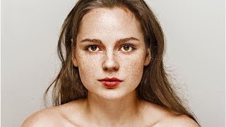 How to Grow Freckles Naturally and Safely [upl. by Koffman]