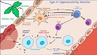 Type IV Hypersensitivity Described Concisely [upl. by Clynes]