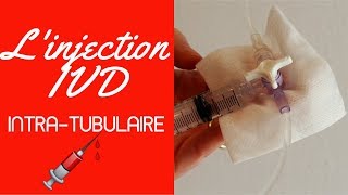 Injection IVD intra tubulaire [upl. by Ycnuahc181]