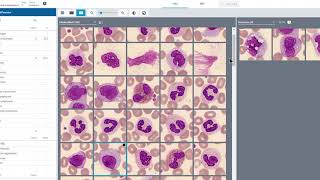 Q amp A How do Tcells recognize antigens [upl. by Romo304]