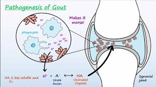 Gout  Mechanisms amp Treatment [upl. by Orodoet]