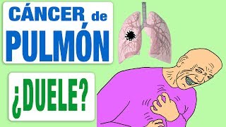 El cáncer de pulmón ¿duele [upl. by Einon]