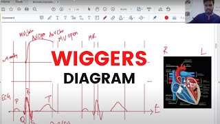 Bioinstrumentation Biopotentials  BiopoenWiggers Diagram  Learn by Drawing [upl. by Fan]