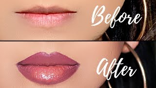 How To Get rid Of Dark Lips And Pigmentation [upl. by Wallack]