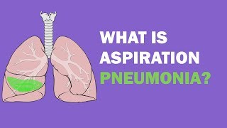 What is aspiration pneumonia [upl. by Dann]