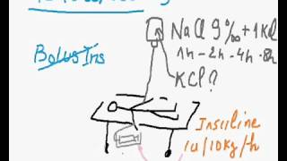 Acidocetose [upl. by Gibe]