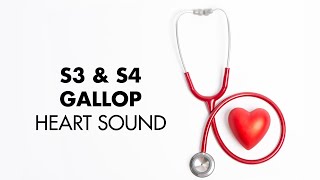 S3 and S4 Gallop  Heart Sounds  MEDZCOOL [upl. by Oneladgam]