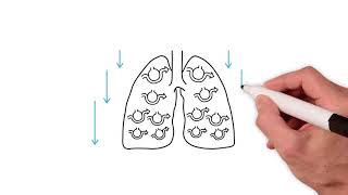 Everything you need to know about the ventilation perfusion ratio [upl. by Eahc]