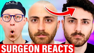 Nathaniel Drew Going Bald Surgeon Reacts [upl. by Vyky]