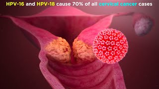 Human Papillomavirus HPV [upl. by Anivol]