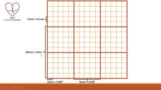 Papel del electrocardiograma y calibración [upl. by Hsirap]