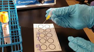 Microbiology Rapid Plasma Reagin RPR Test [upl. by Nereus]