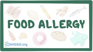 Food allergy  an Osmosis Preview [upl. by Eecyak197]