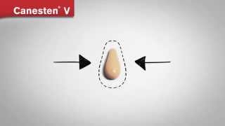 CANESTEN V Aplicación óvulos [upl. by Pinto]