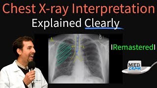 XRay Scanner Pro free app for Android [upl. by Florie394]