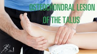 Osteochondral lesion of the talus OCD lesion Signs symptoms and treatment options [upl. by Amos311]