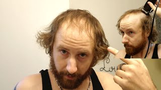 BALDING MAN Shaves Head Bald TOTALLY TRANSFORMING His Look [upl. by Yllod791]