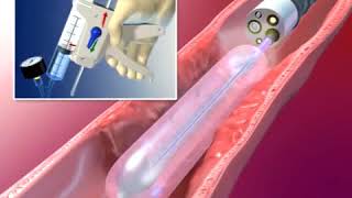 AngioDynamics BioFlo PICC Care and Maintenance Instructional Video [upl. by Koss]