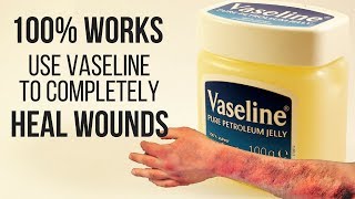 100 WORKS USE VASELINE TO COMPLETELY HEAL WOUNDS [upl. by Atik]