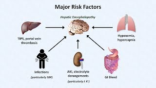 Hepatic Encephalopathy [upl. by Ahmed603]